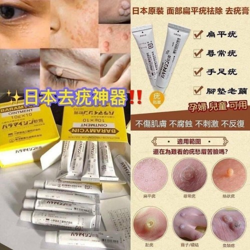 日本皮膚醫學博士強力推薦 去疣神膏